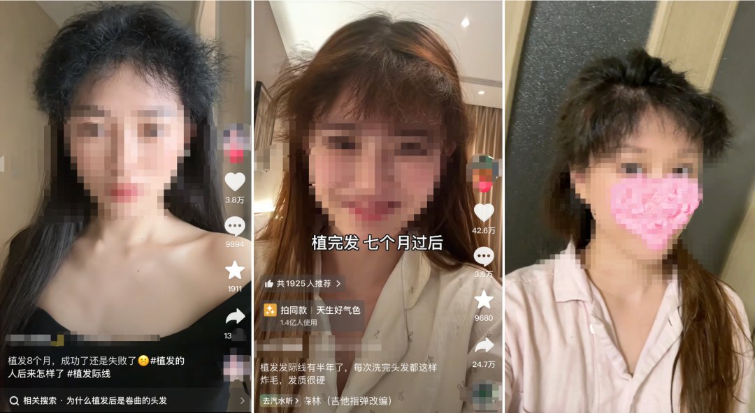 “割完”男人,“植发一哥”雍禾又来抱女性大腿了
